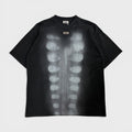 Printed t-shirt x-ray
